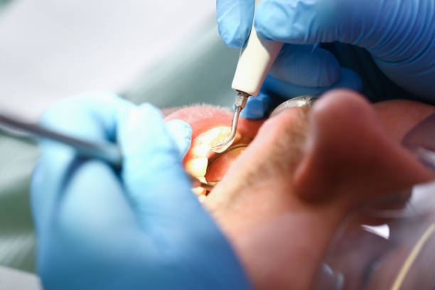 Best Weekend Emergency Dentist in Mercerville, NJ
