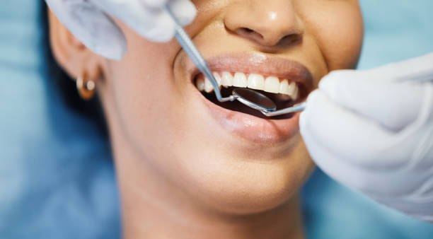 Best Emergency Tooth Extraction in Mercerville, NJ